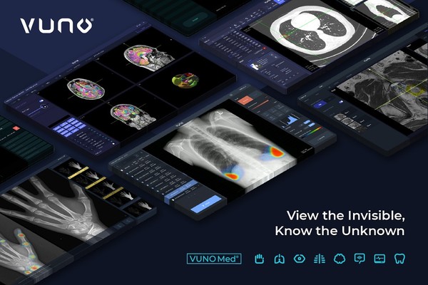 뷰노메드 솔루션 3개 제품 ▲뷰노메드 체스트 엑스레이™ ▲뷰노메드 흉부CT™ ▲뷰노메드 펀더스 AI™ (뷰노 제공)